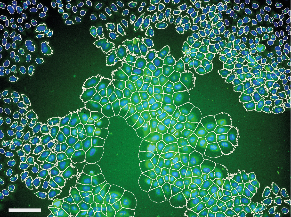 General illumination correction for optical microscopy