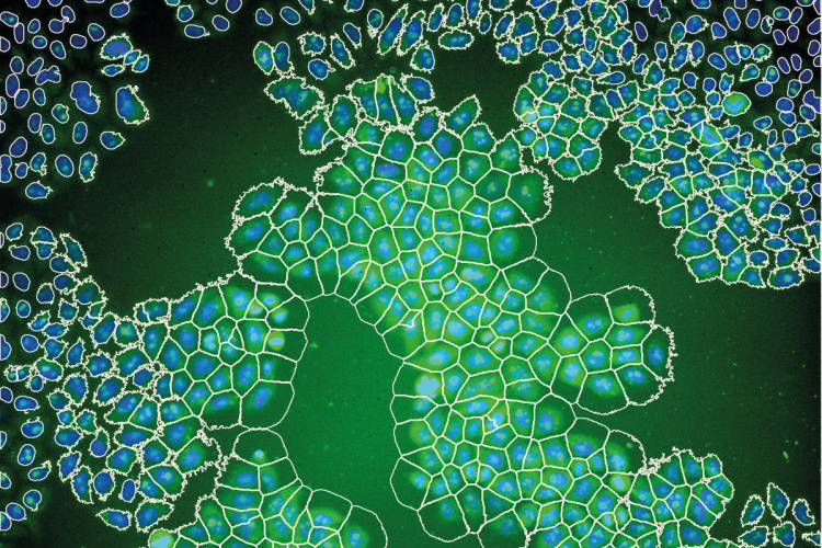 Typical effect of uneven illumination on the automatic segmentation of HeLa cells from a high content screen.