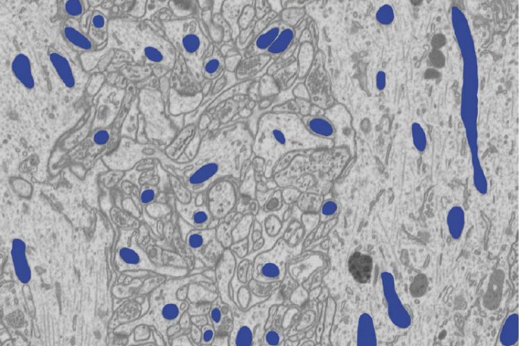 Mitochondria segmentation in EM slices